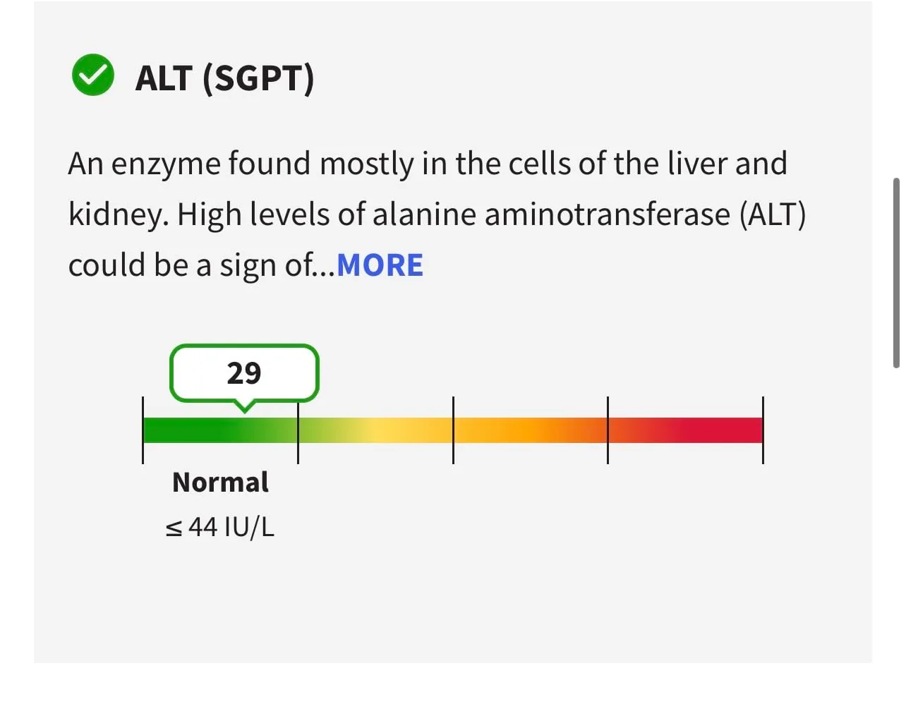 Customer review photo for Milk Thistle: The Science Behind the Most Popular Liver Supplement on the Market