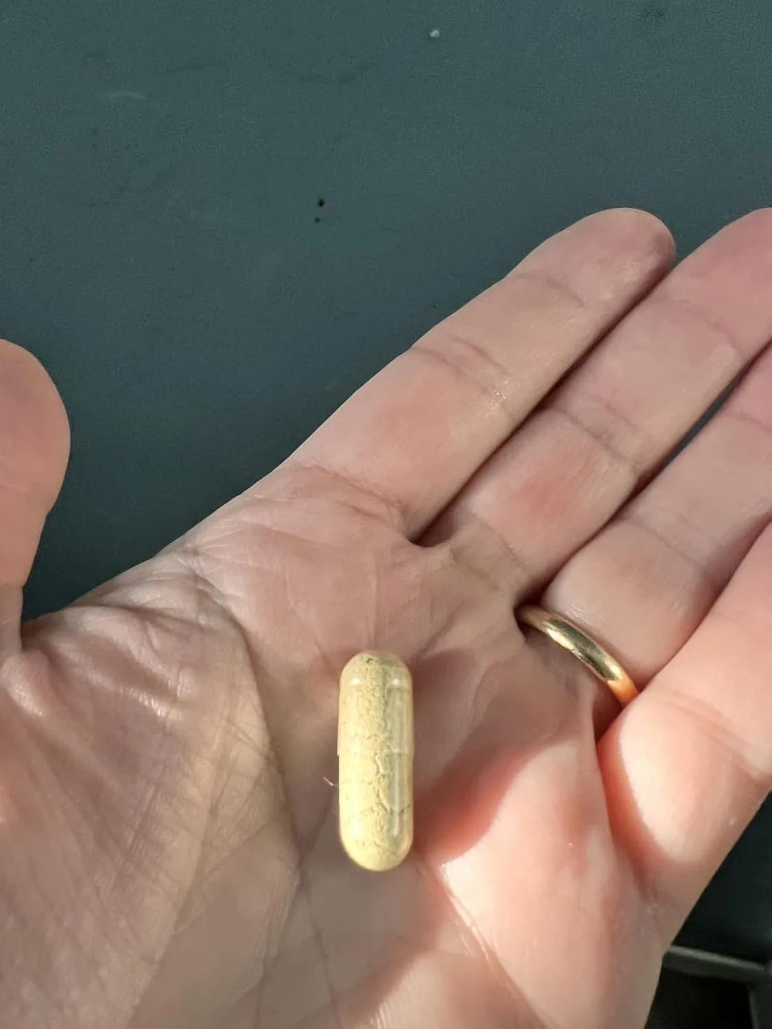 Customer photo of gut microbiome test kit contents and materials included